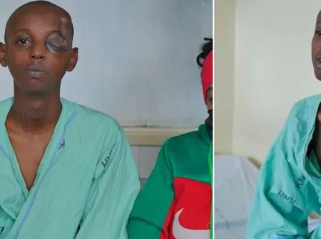 KNH Surgeons Save Teen with a Knife Lodged in the Eye