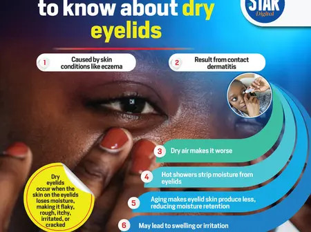 What you need to know about dry eyelids