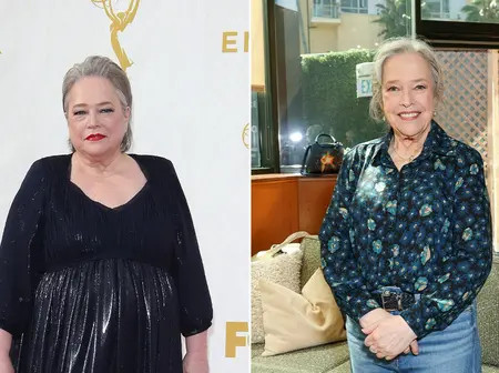 Gastric Bypass vs. Ozempic: The Weight-Loss Debate in Kenya’s Celebrity Circles